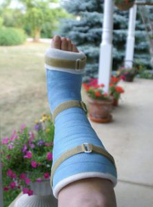 broken ankle